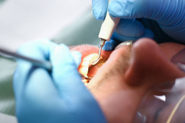 Best Emergency Treatment for Toothache in Shpee Neck, MA